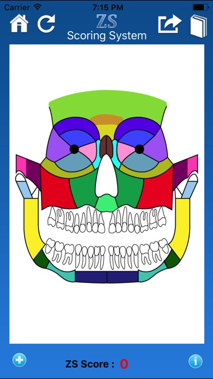 ZS Maxillofacial Trauma Score