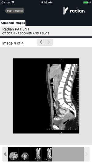 Radian Patient Access(圖5)-速報App