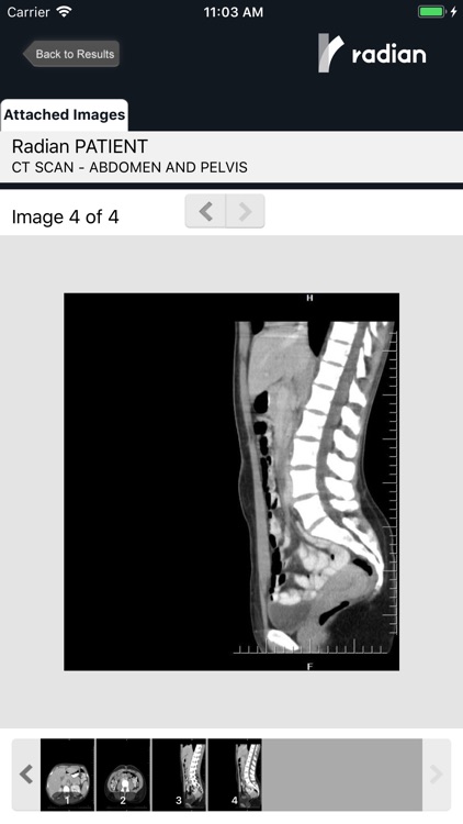 Radian Patient Access screenshot-4