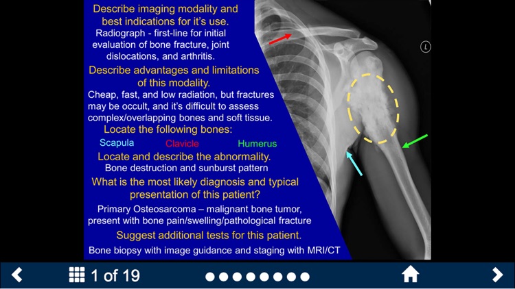 Basic Radiology - Secondlook