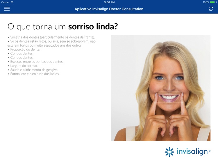 Invisalign Experience