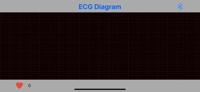 Jabil-ECG