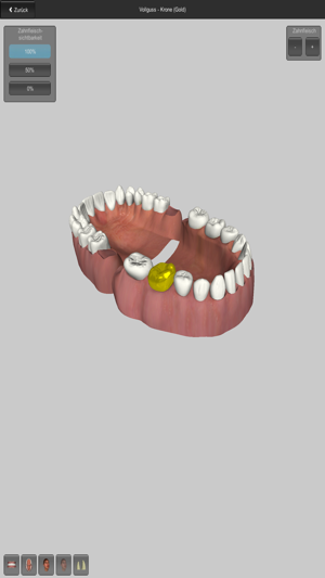 CGM VISODENT 3D App(圖3)-速報App