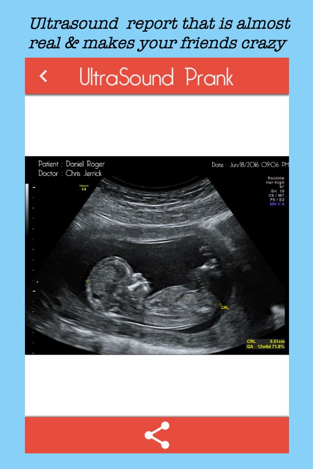 Baby Ultrasound spoof screenshot 2