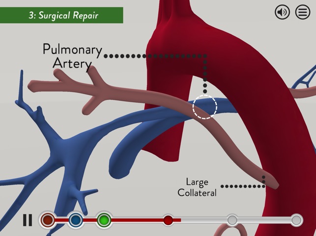 Child Heart Surgery(圖5)-速報App