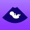 Ultrasound Prank Pro - Pregnant Spoof And Fake Pregnancy Trick by Wally World