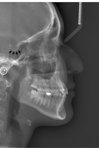 Oral Radiology screenshot 3