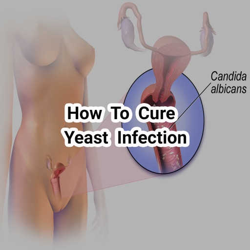 How To Cure Yeast Infection