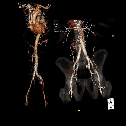 Medications in Interventional Radiology