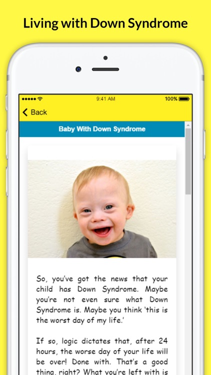 Living with Down Syndrome - Facts and Symptoms screenshot-3