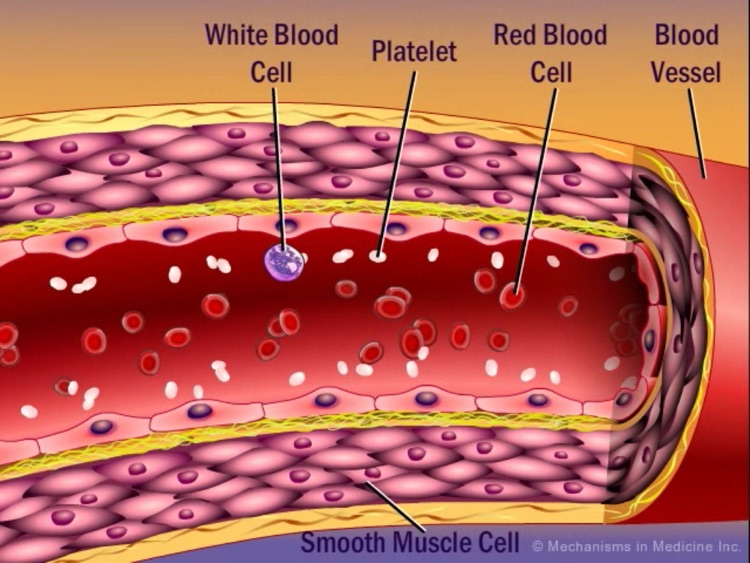 Mechanisms in Hematology screenshot-4