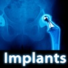 Implants Study