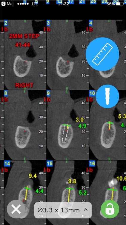 CBCT Ruler