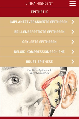 Epithesen Linha Highdent screenshot 2