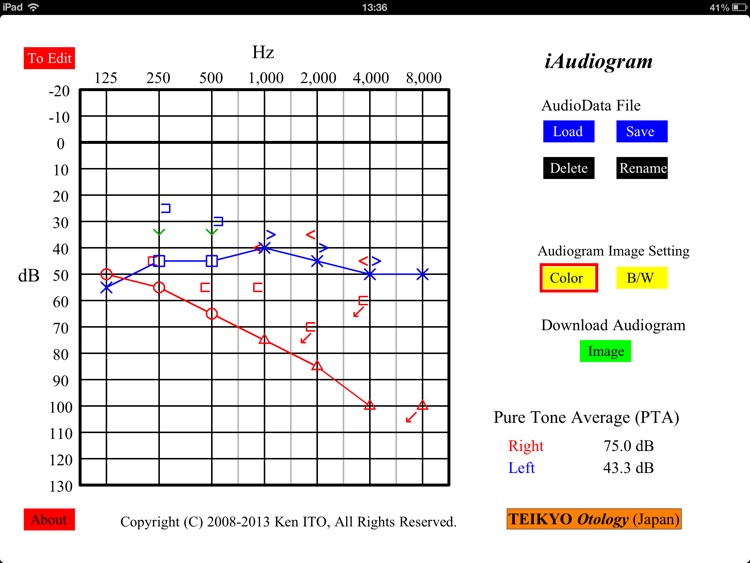 iAudiogram