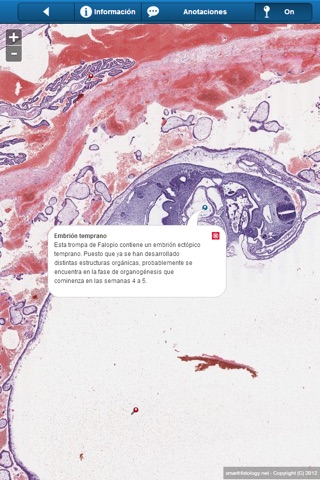 Smart Histology Lite screenshot 3