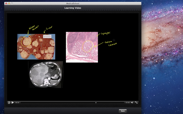 Medical School(圖4)-速報App