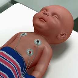Infant Endotracheal Intubation