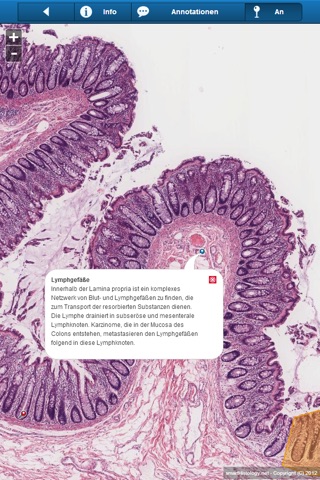 Smart Histology screenshot 4