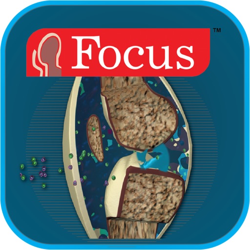 Atlas of Rheumatoid Arthritis