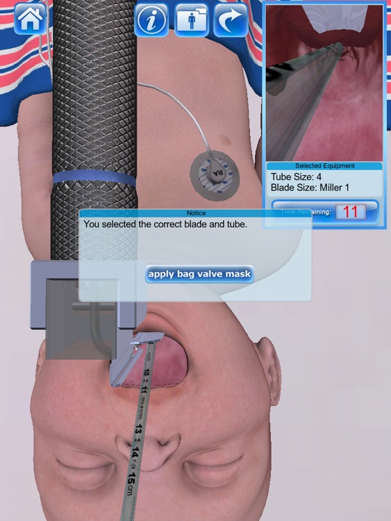 Infant Endotracheal Intubation