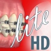 Dentapedia HD (Orthodontics) Lite