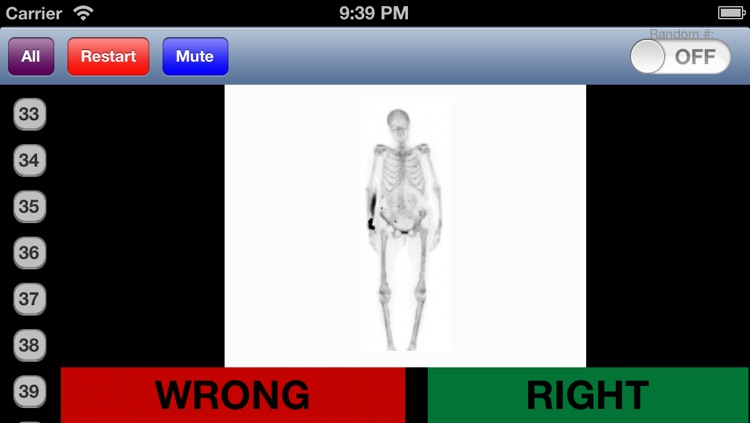 Nuclear Medicine Flashcards