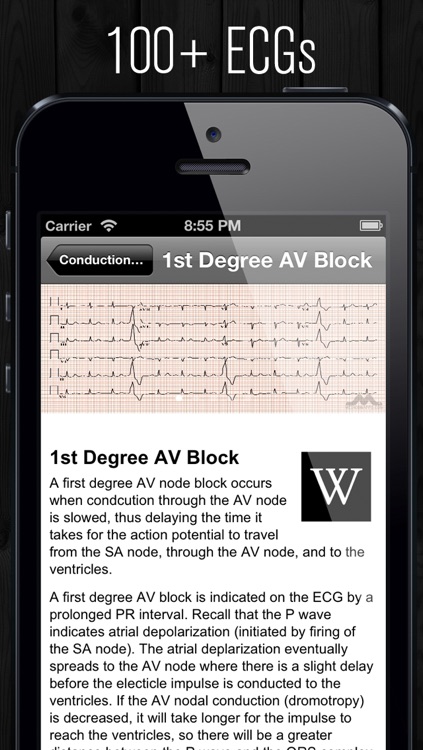 ECG Atlas screenshot-4