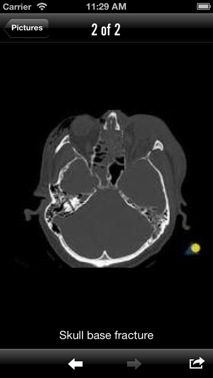 Neurointensive Care Guide