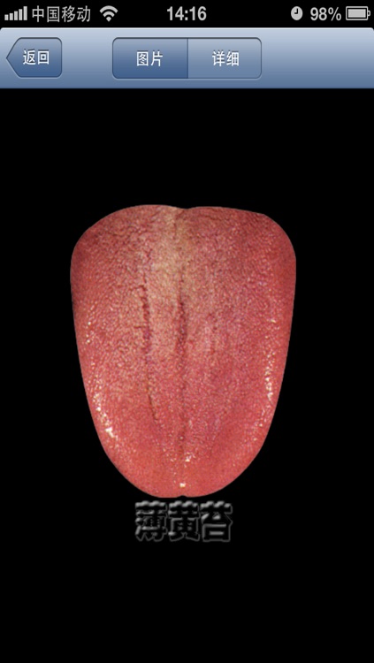 望舌知健康