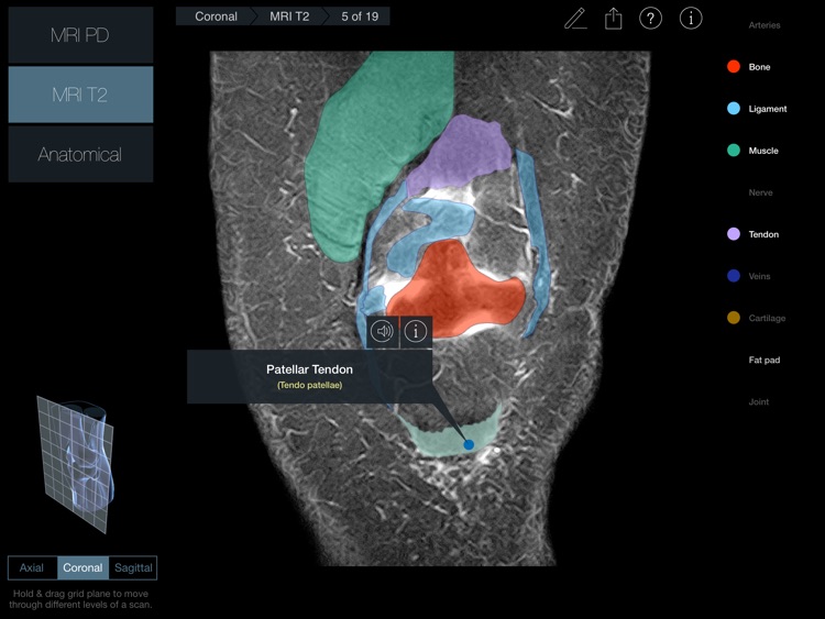 Radiology - Knee screenshot-3