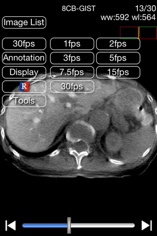 iMedViewer screenshot 4