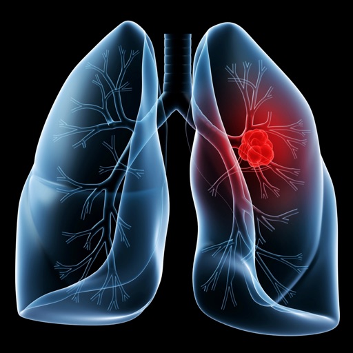 Lung Cancer:Research,Symptoms and Treatment icon