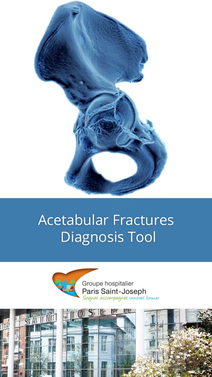 Acetabular Diagnosis Tool