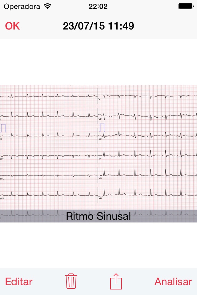 Photo EKG screenshot 3