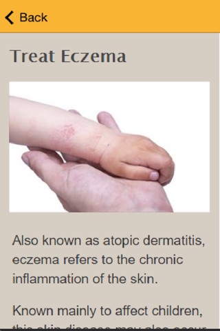 How To Treat Eczema screenshot 3