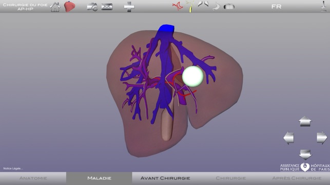 Chirurgie du foie AP-HP(圖1)-速報App