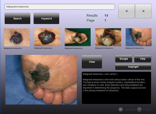 YSP Dermatology Image Database for iPad