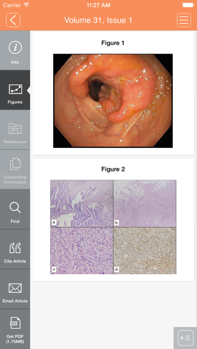 How to cancel & delete Journal of Gastroenterology and Hepatology from iphone & ipad 3