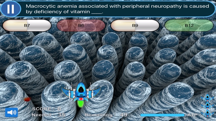 USMLE Step 1 & COMLEX Level 1 Buzzwords Game: Preclinical Review for M1 (Gross Anatomy to Physiology) and M2 (Pathology to Pharmacology) Medical Students (Scrub Wars) LITE screenshot-3
