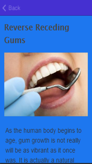 How To Stop Receding Gums(圖2)-速報App