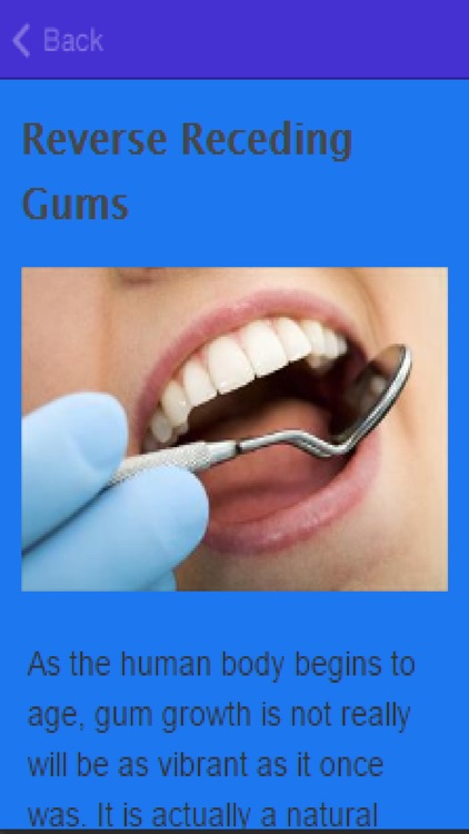 How To Stop Receding Gums