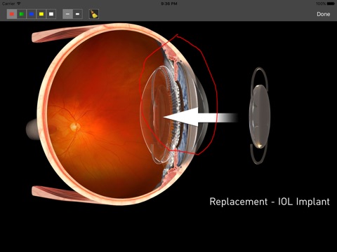 Eye Care Pro screenshot 3