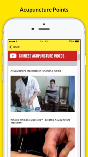 Chinese Acupuncture Therapy - Treatment For Weight Loss(圖4)-速報App