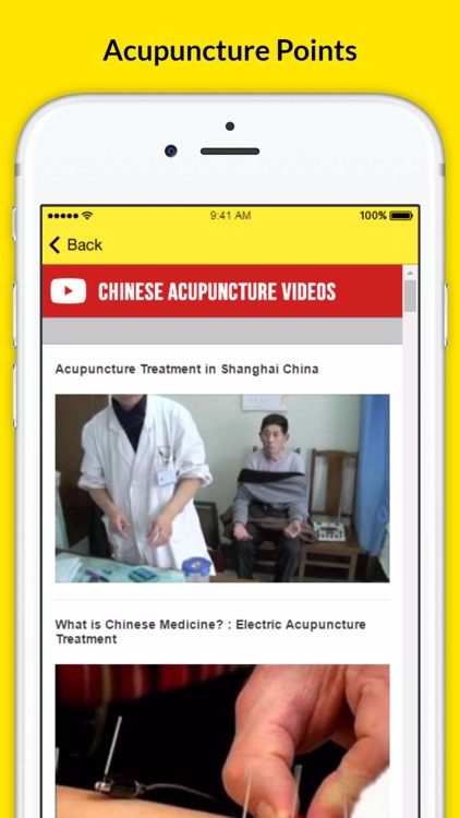 Chinese Acupuncture Therapy - Treatment For Weight Loss screenshot-3