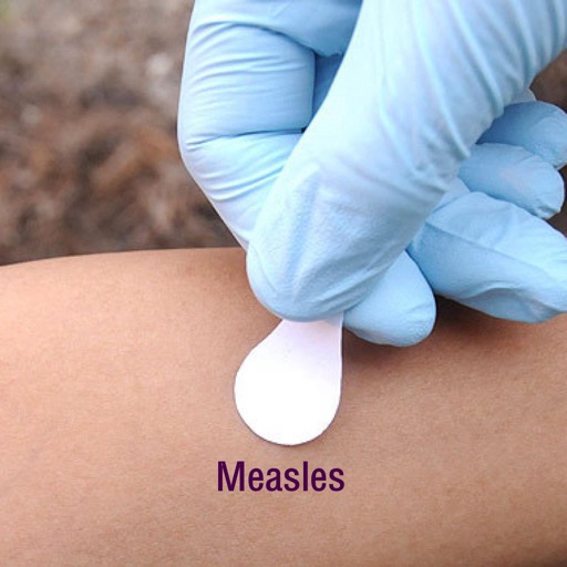 Measles: Guide with Glossary and Top News icon