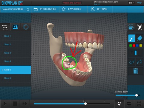 Showplan-DX - Dental screenshot 3