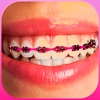 Braces Photo Editor - Stickers