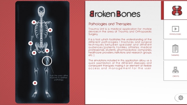 Broken Bones
