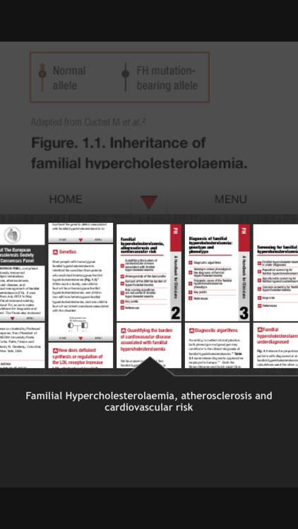 Familial Hypercholesterolaemia